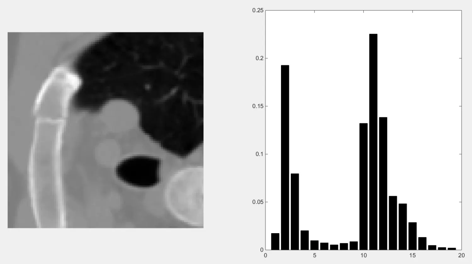 左图是原始的CT图像,右图是该图像的直方图