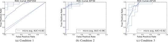 ROC curves of each condition.