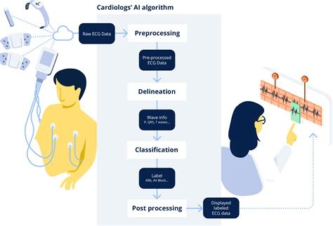 Real-life application of Artificial Intelligence for ECG analysis ...
