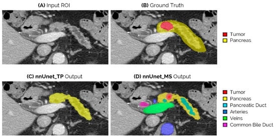 癌症 14 00376 g004 550