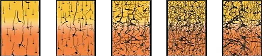 人脑神经网络变化示意图